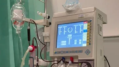 Mesin hemodialisis digunakan untuk prosedur cuci darah di klinik.